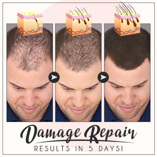 Oveallgo Glamor Ginger Essential Hair Growth Cream - Image 7