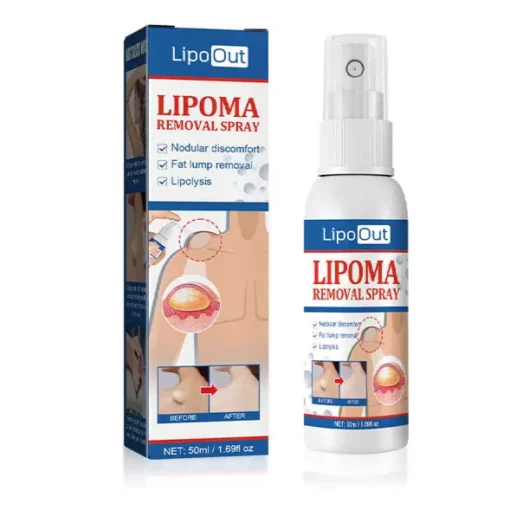 Lipoma Removal Herbal Spray