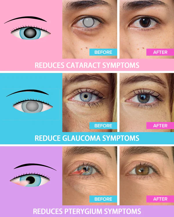 Juenow™ REBRIGHT Natürliche Kräuterdampf-Augenmaske - Image 7