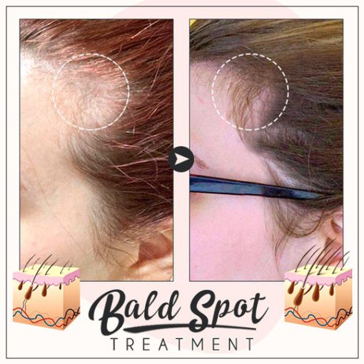 Oveallgo Glamor Ginger Essential Hair Growth Cream - Image 5