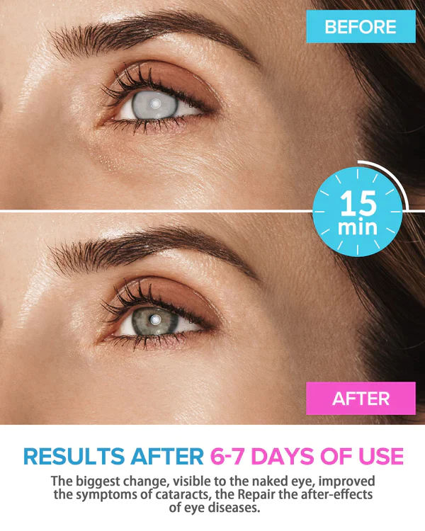 Juenow™ REBRIGHT Natürliche Kräuterdampf-Augenmaske - Image 6