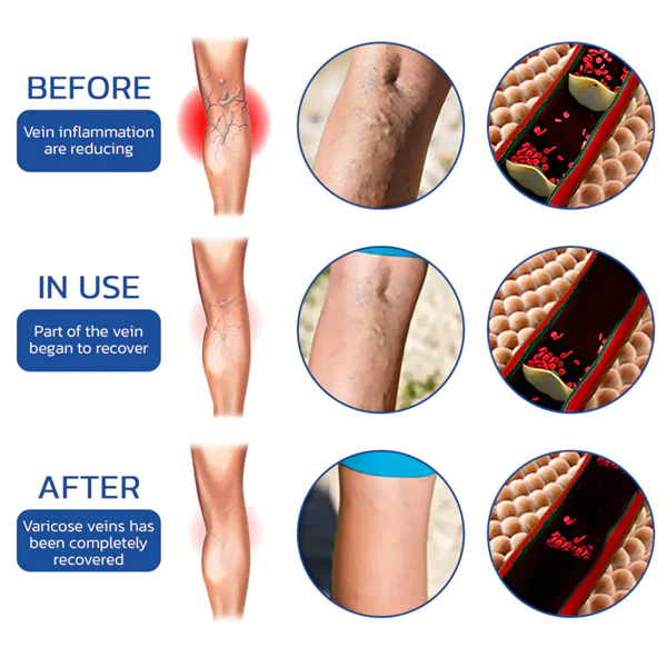 Fivfivgo™ UltraSLIM Tourmaline Ion Body Shaping Stretch-Seidenstrümpfe - Image 5