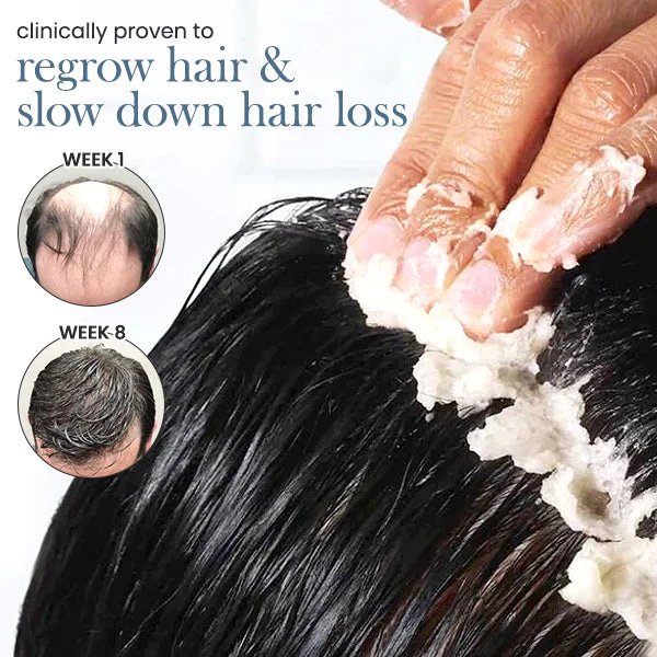 Blusoms™ RootRestore Hair Scrub - Image 3