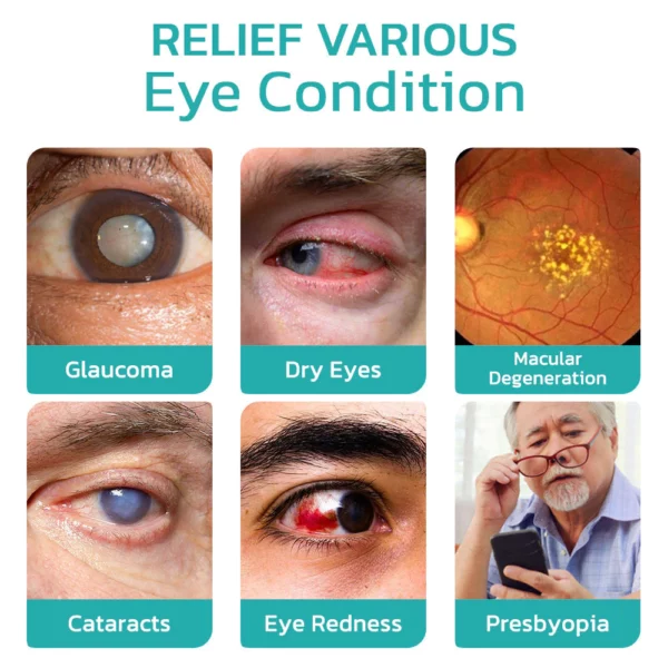 CNDB OphthlaMed Vision Enhance Roller - Image 5