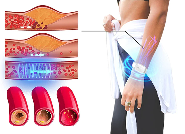 KTMAC™Ultrasonic Fat Burning Bracelet - Image 7