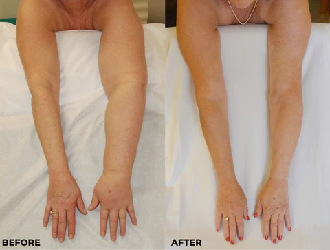 BioHerbs™ LymphaticDrainage Shower Gel - Image 7