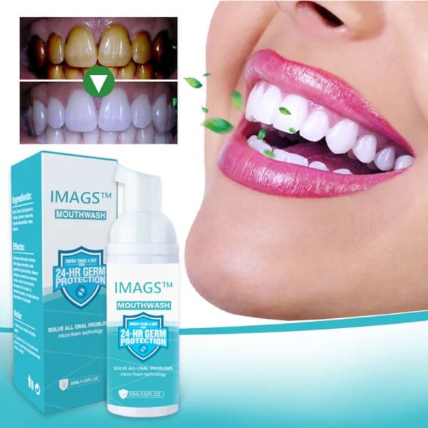 IMAGS™ Pure Herbal Teeth Whitening & Mouth Repair Mousse - Image 7