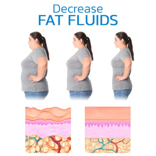 Ultrasonic Liposuction Machine - Image 7