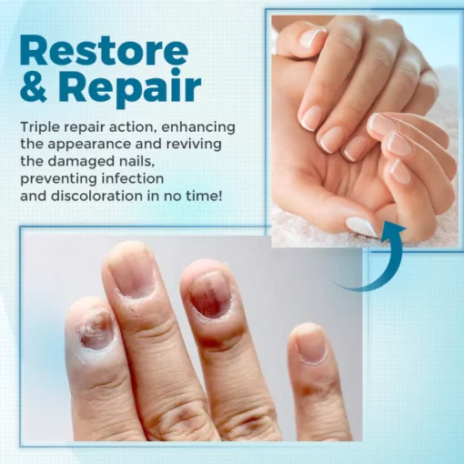 Biancat™ FungiClear Nail Treatment Cream - Image 8