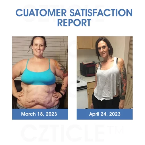 CZTICLE™ Titanium Ion Lymphatic Drainage Watch - Image 10