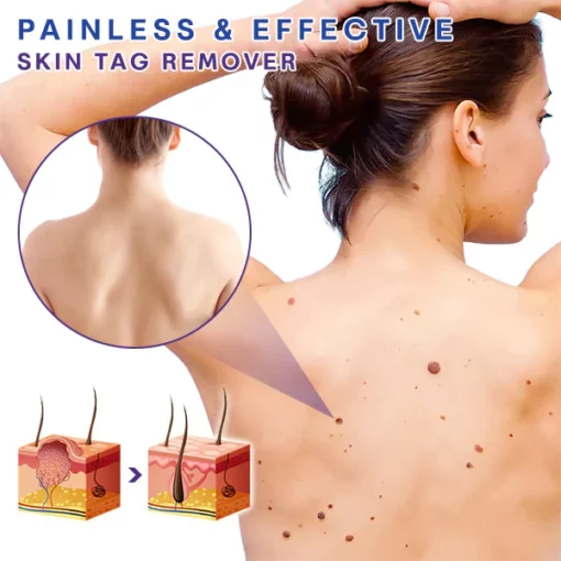 CC™ Lucid TagOutXpress Remover - Image 6