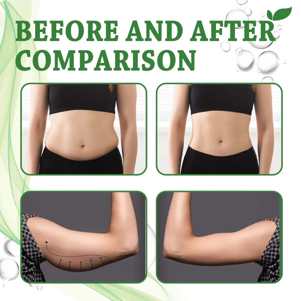 SlimVita™ Comfrey Tightening Body-Balm - Image 6