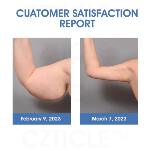 CZTICLE™ Titanium Ion Lymphatic Drainage Watch - Image 9