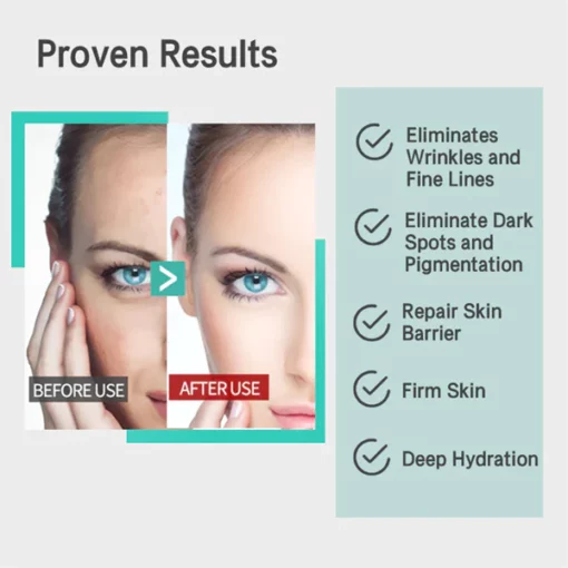 Oveallgo™ MMP Reverse Anti-Wrinkle Antioxidant Serum - Image 6