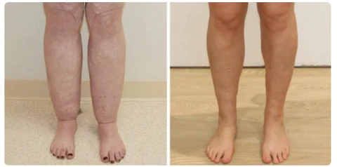 BioHerbs™ LymphaticDrainage Shower Gel - Image 6