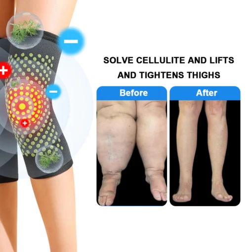 SfrCord® Fulgurite Ionic Body Shaping Stretch Knee Brace - Image 4