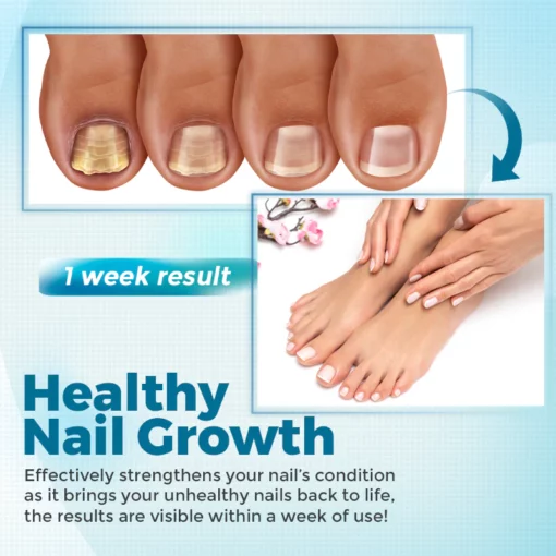 Biancat™ FungiClear Nail Treatment Cream - Image 7