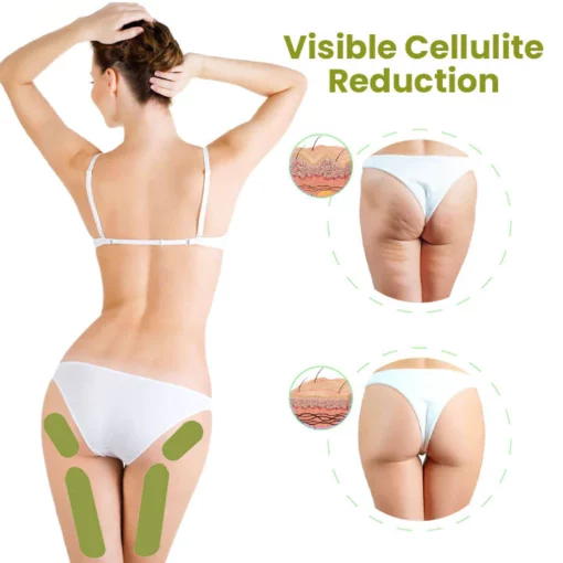 Oveallgo™ HerbalFirm PURE Cellulite Reduction Patches - Image 8