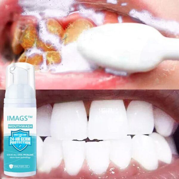 IMAGS™ Pure Herbal Teeth Whitening & Mouth Repair Mousse - Image 6