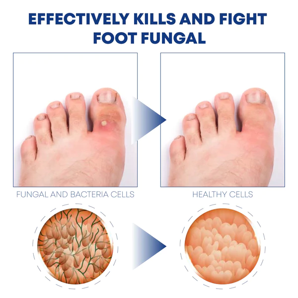 ATTDX FootCare AntiFungal HerbalBath Treatment - Image 4