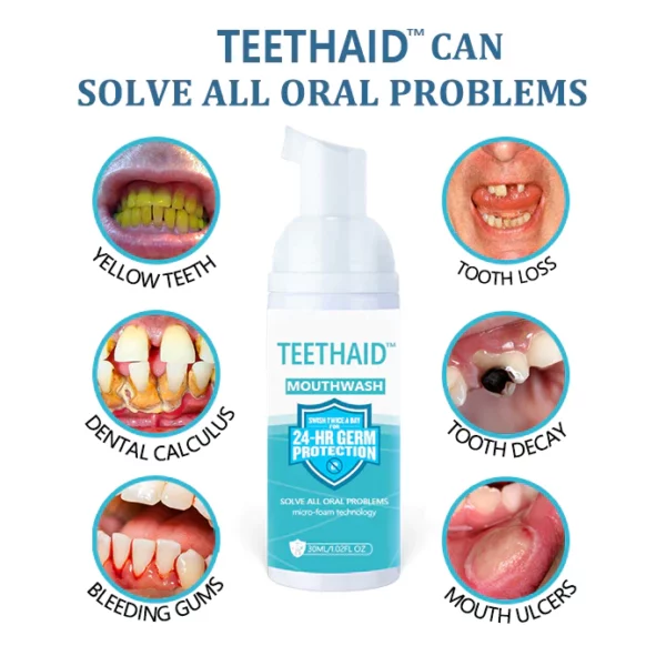 Teethaid™ Mouthwash Calculus Removal Tooth Regeneration - Image 5