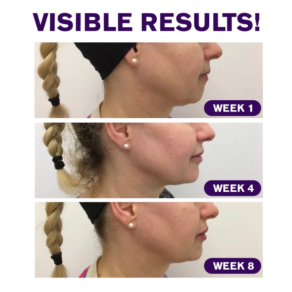 ATTDX Waterproof Invisible FacialLifting Patch - Image 5