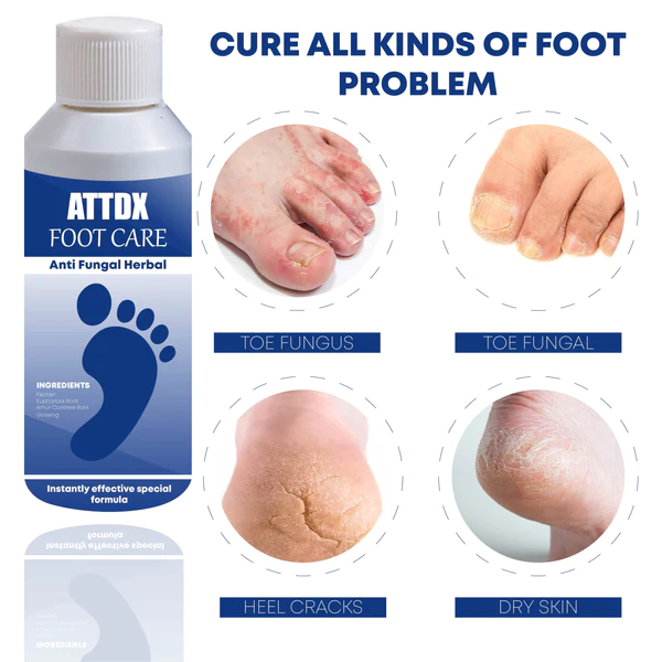 ATTDX FootCare AntiFungal HerbalBath Treatment - Image 3