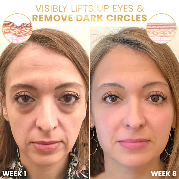 Liascy™ Le Lift ProxylanEssence Eye Cream - Image 6