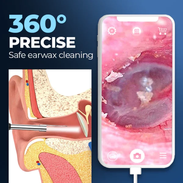 ViewScan™ Visible Earwax Cleaning Otoscope - Image 7
