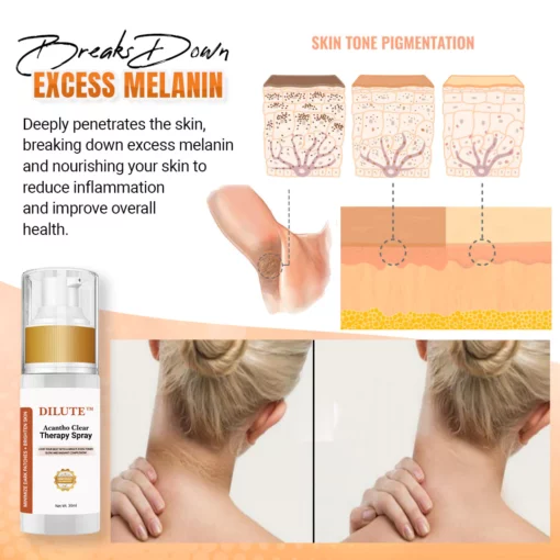 DILUTE™ Acantho Clear Therapy Spray - Image 7