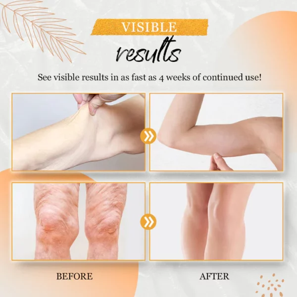 Anti-Cellulite Body Shaping Cream - Image 8