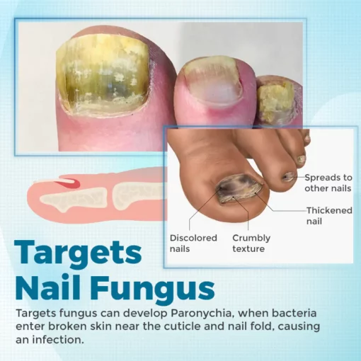 Biancat™ FungiClear Nail Treatment Cream - Image 5