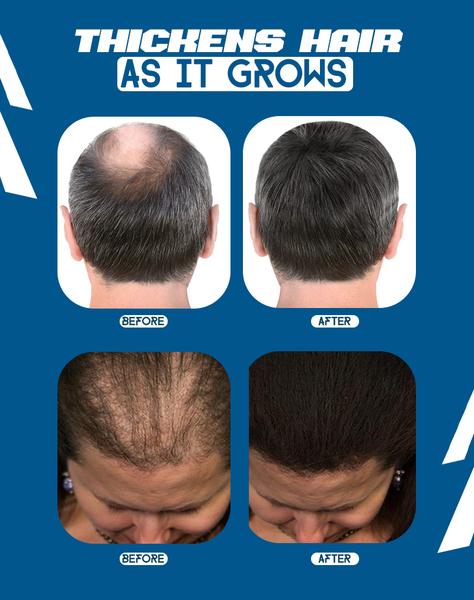 FOLIGAIN Men HairRegrowth EssenceSpray with Roller - Image 5