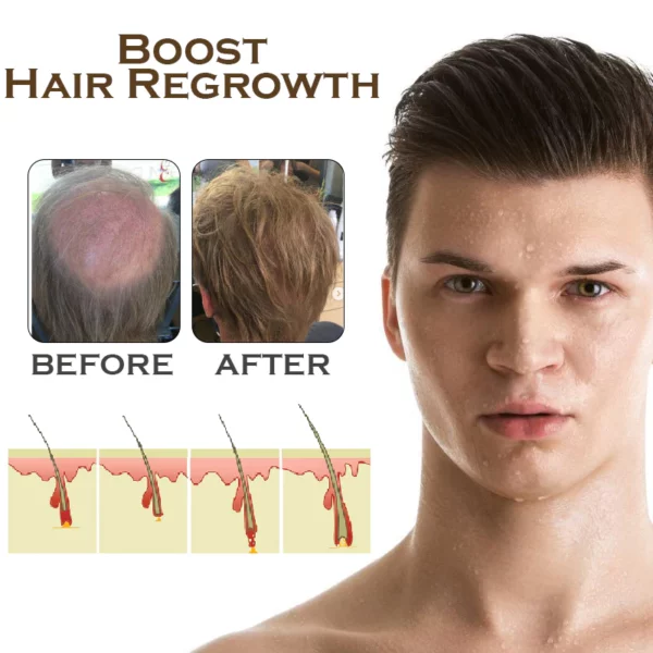 ATTDX PureGinger HairRegrowth Treatment Spray - Image 4