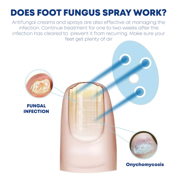 ATTDX FootCare AntiFungal HerbalBath Treatment - Image 7