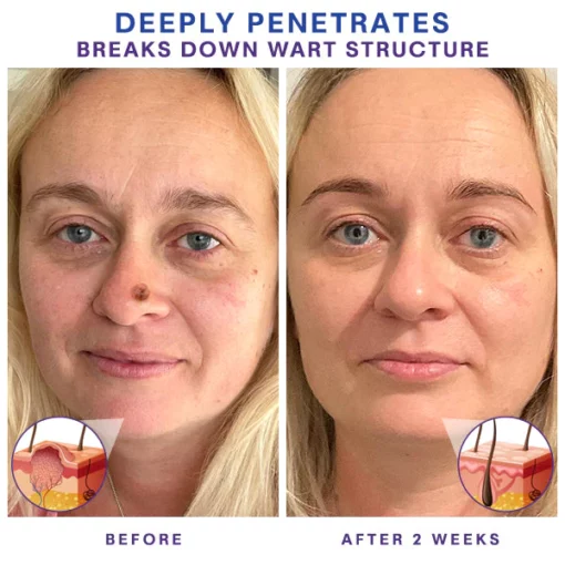 CC™ Lucid TagOutXpress Remover - Image 4