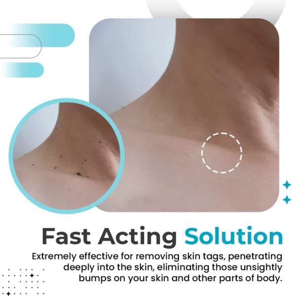 DermiClearPlus™ Skin Tag & Wart Remover Pen - Image 7