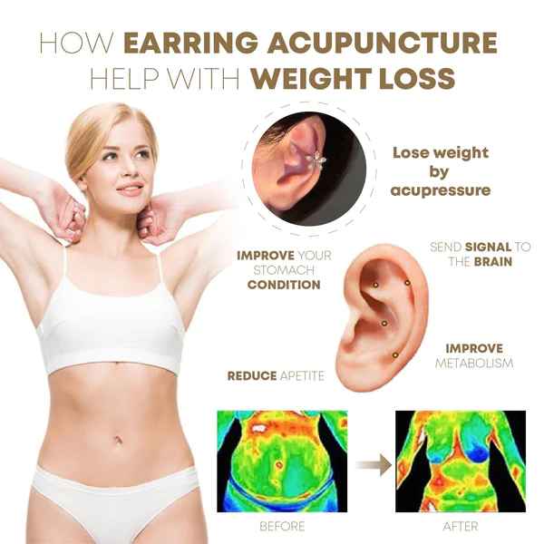 KHLORIS AcupoinTheropie Flower EarClip - Image 5