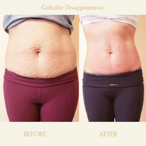 Ceoerty™ Anti-Cellulite Firming Soap - Image 3