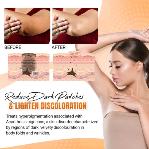 DILUTE™ Acantho Clear Therapy Spray - Image 5