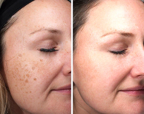 RevitaCare™ Anti-Aging Bio Essence - Image 4