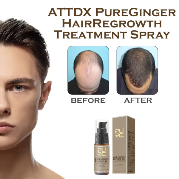 ATTDX PureGinger HairRegrowth Treatment Spray - Image 3