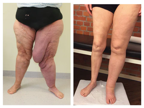 MedMax Professional Kidney Care Patch - Image 3