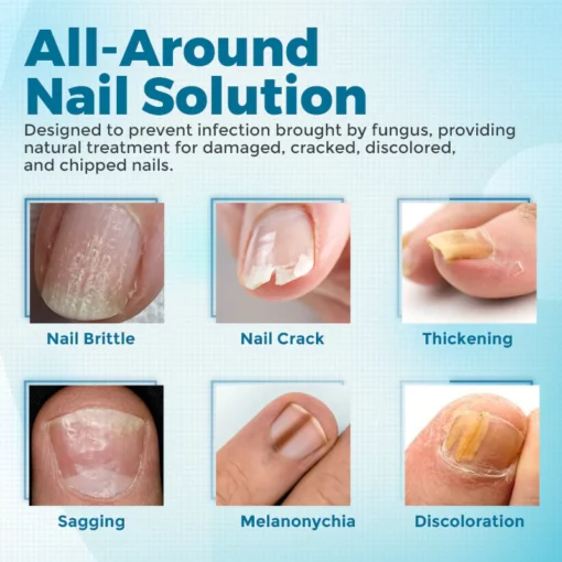 Biancat™ FungiClear Nail Treatment Cream - Image 4