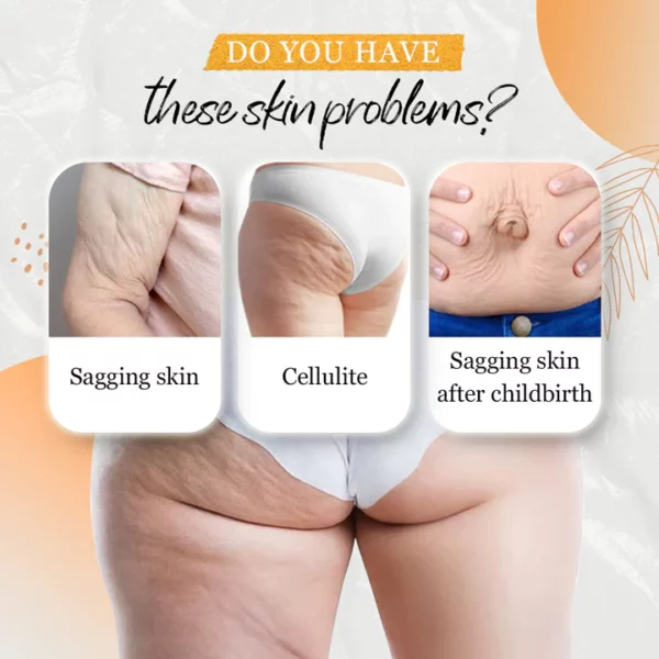 Anti-Cellulite Body Shaping Cream - Image 7