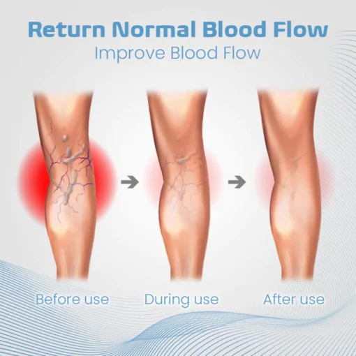 Ceoerty™ Acupressure Magnetic Insoles - Image 4