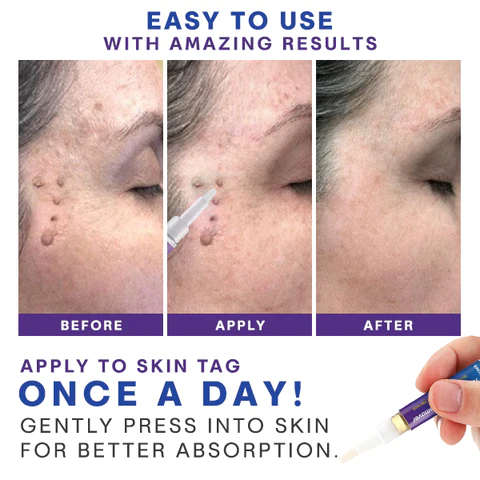 CC™ Lucid TagOutXpress Remover - Image 3