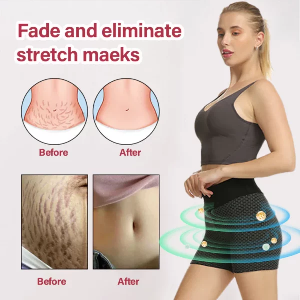 SHAPERMOV Ion Breathable Shaping Shorts - Image 12