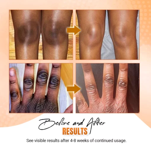 DILUTE™ Acantho Clear Therapy Spray - Image 9