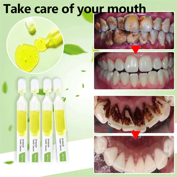Oveallgo™ PRO Ampoule Tooth Serum - Image 2